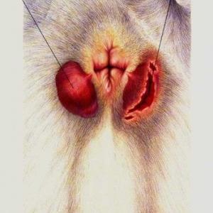 Hemorrhoidal Symptoms - Hemorroids - A Pain In The Butt