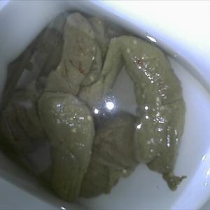 Hemorrhoid Cream - Initial Examination By A Doctor For Hemorrhoids
