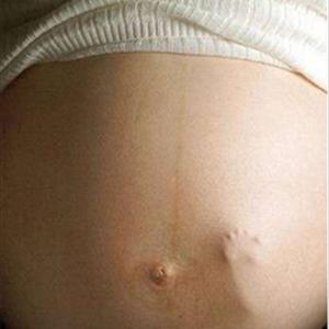 Hemorrhoids External Medication - Symptoms Of Hemorrhoids